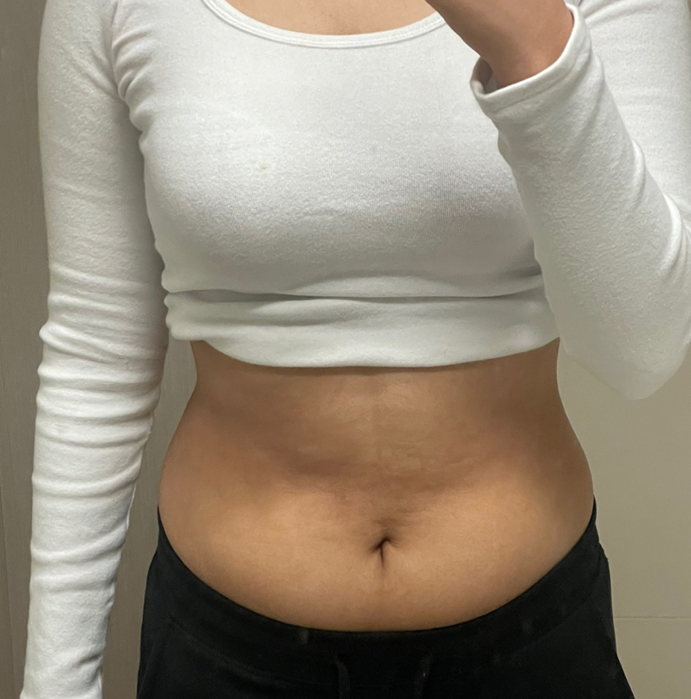 Before Image