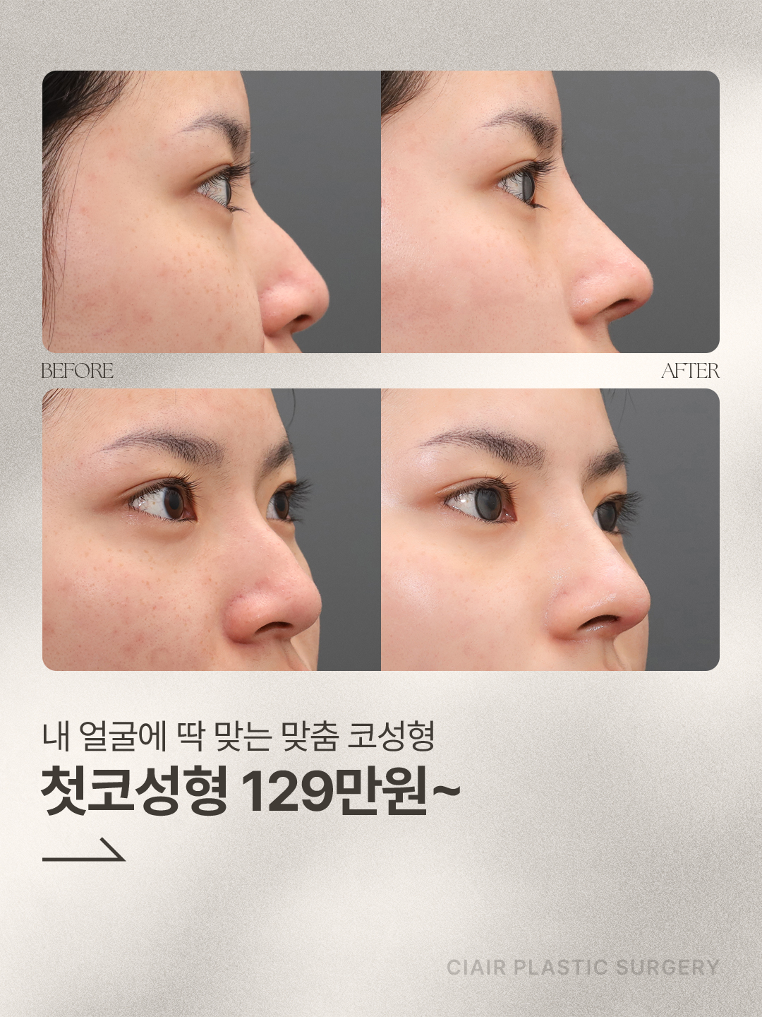 Before 8 Front