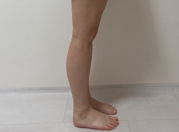 종아리 지방분해주사