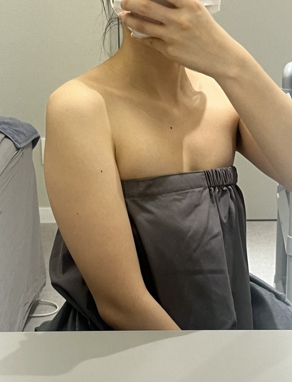 팔뚝 지방분해주사