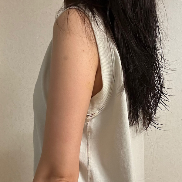 팔뚝 지방분해주사